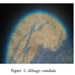 Figure 2: Albugo candida