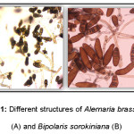 Figure 1: Different structures of Alernaria brassicicola (A) and Bipolaris sorokiniana (B)