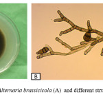 Figure 1. Pure culture of Alternaria brassicicola (A) and different structures of Alternaria brassicicola (B)